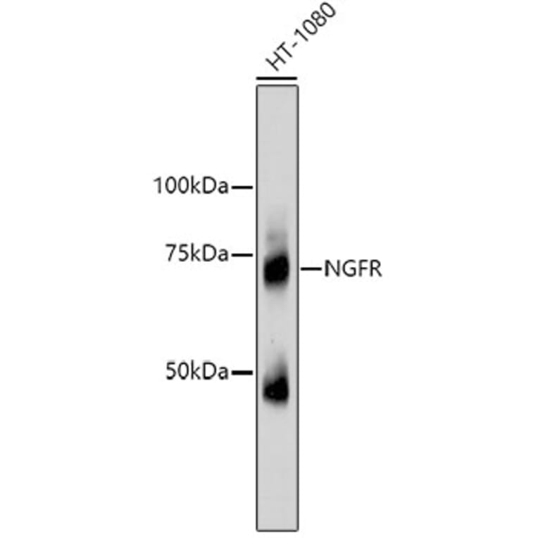Western Blot - Anti-NGFR Antibody (A11050) - Antibodies.com