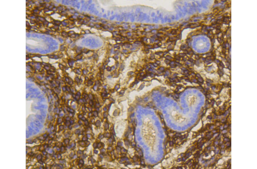 Immunohistochemistry - Anti-NGFR Antibody (A11050) - Antibodies.com