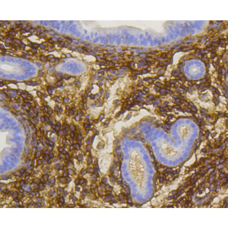 Immunohistochemistry - Anti-NGFR Antibody (A11050) - Antibodies.com
