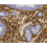 Immunohistochemistry - Anti-NGFR Antibody (A11050) - Antibodies.com