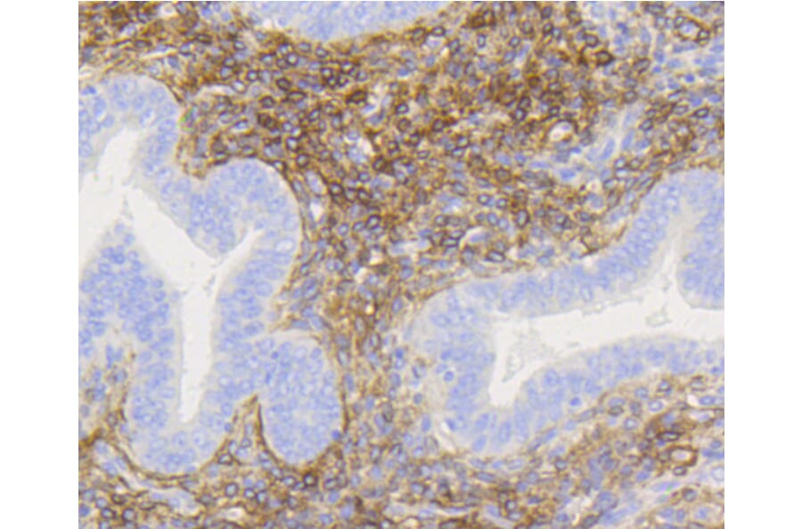 Immunohistochemistry - Anti-NGFR Antibody (A11050) - Antibodies.com