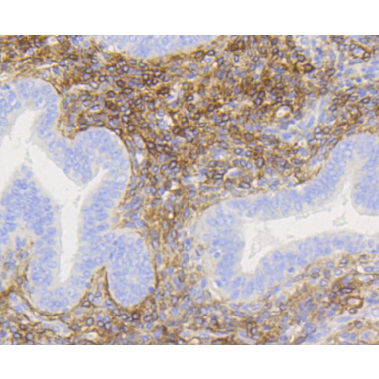 Immunohistochemistry - Anti-NGFR Antibody (A11050) - Antibodies.com