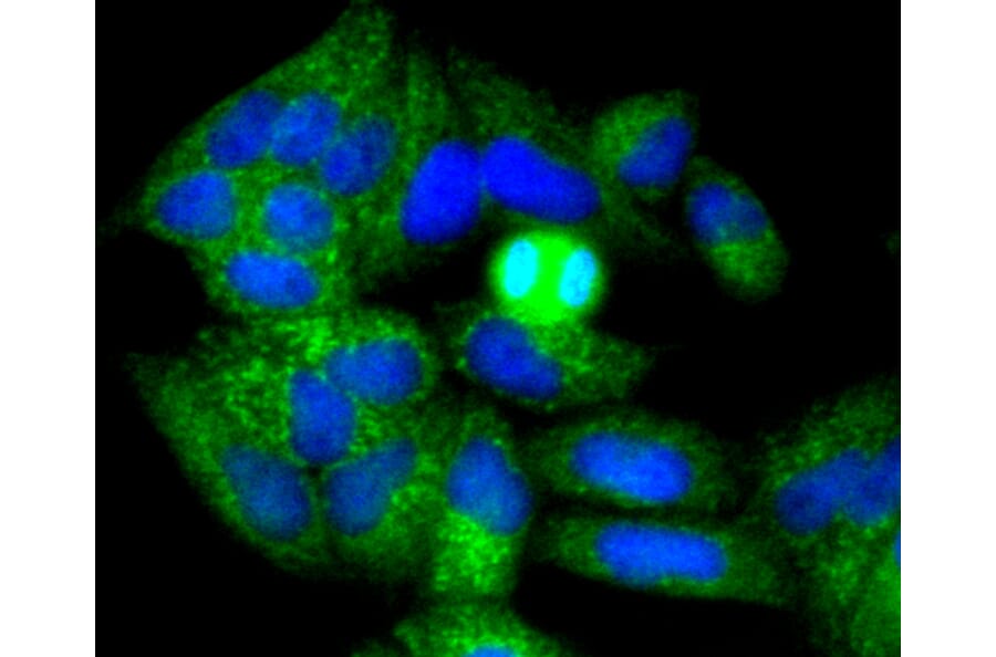 Immunofluorescence - Anti-NGFR Antibody (A11050) - Antibodies.com