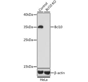 Western Blot - Anti-Bcl10 Antibody (A13208) - Antibodies.com