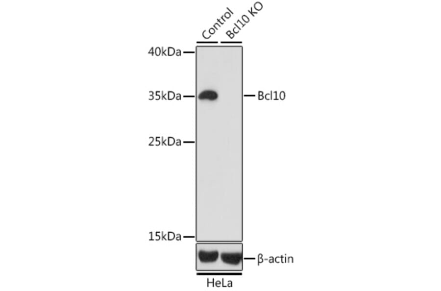 Western Blot - Anti-Bcl10 Antibody (A13208) - Antibodies.com