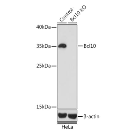 Western Blot - Anti-Bcl10 Antibody (A13208) - Antibodies.com
