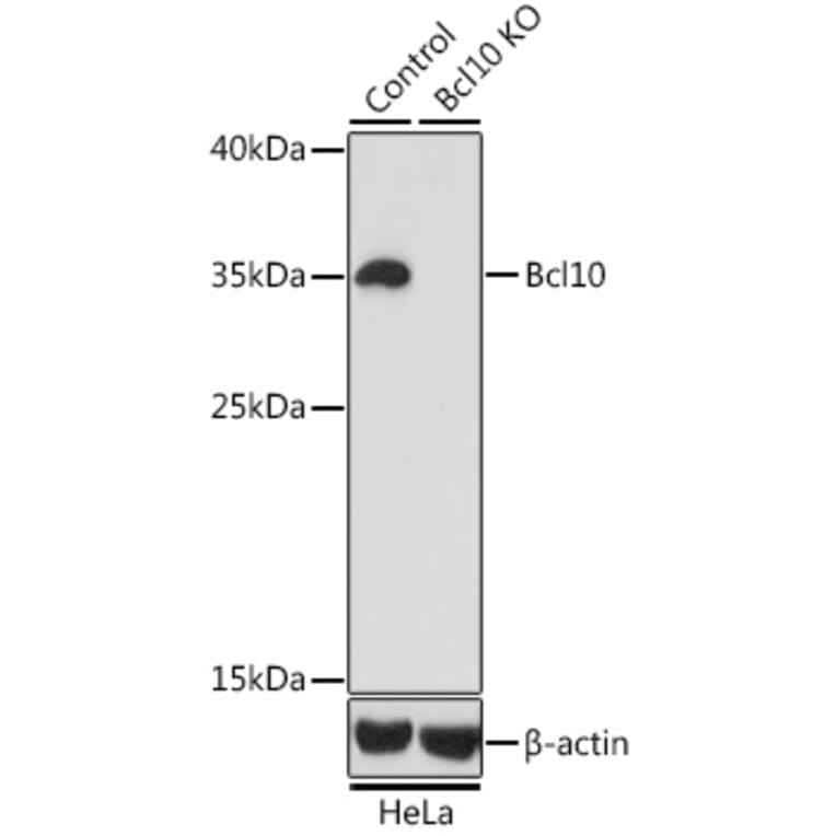 Western Blot - Anti-Bcl10 Antibody (A13208) - Antibodies.com