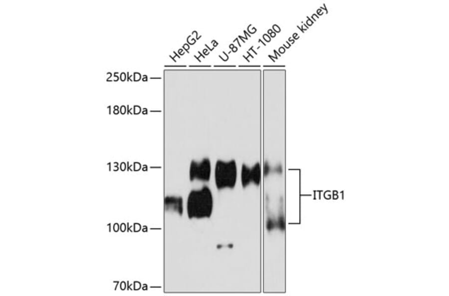 Western Blot - Anti-Integrin beta 1 Antibody (A11060) - Antibodies.com