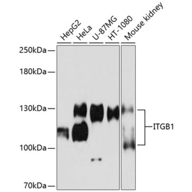 Western Blot - Anti-Integrin beta 1 Antibody (A11060) - Antibodies.com