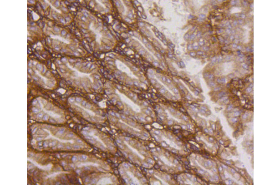 Immunohistochemistry - Anti-Integrin beta 1 Antibody (A11060) - Antibodies.com