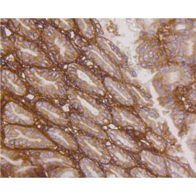 Immunohistochemistry - Anti-Integrin beta 1 Antibody (A11060) - Antibodies.com