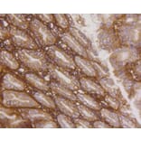 Immunohistochemistry - Anti-Integrin beta 1 Antibody (A11060) - Antibodies.com
