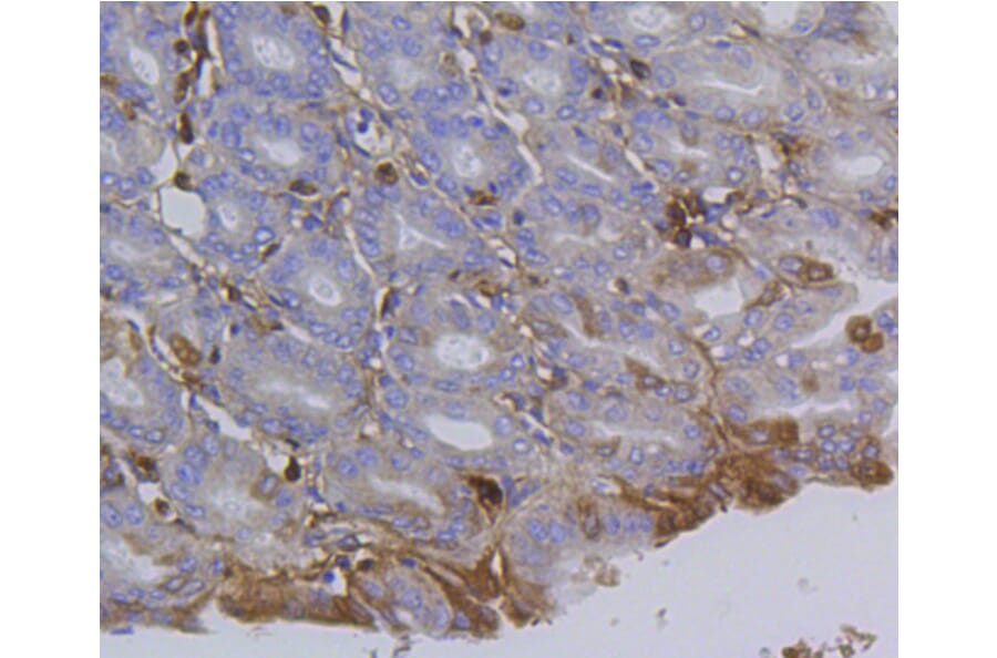 Immunohistochemistry - Anti-Integrin beta 1 Antibody (A11060) - Antibodies.com