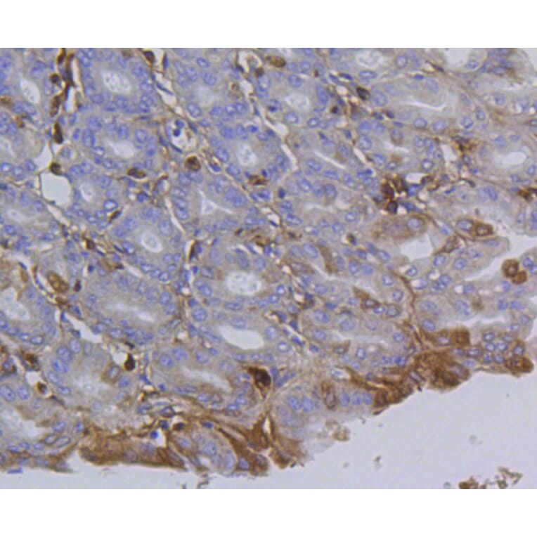 Immunohistochemistry - Anti-Integrin beta 1 Antibody (A11060) - Antibodies.com