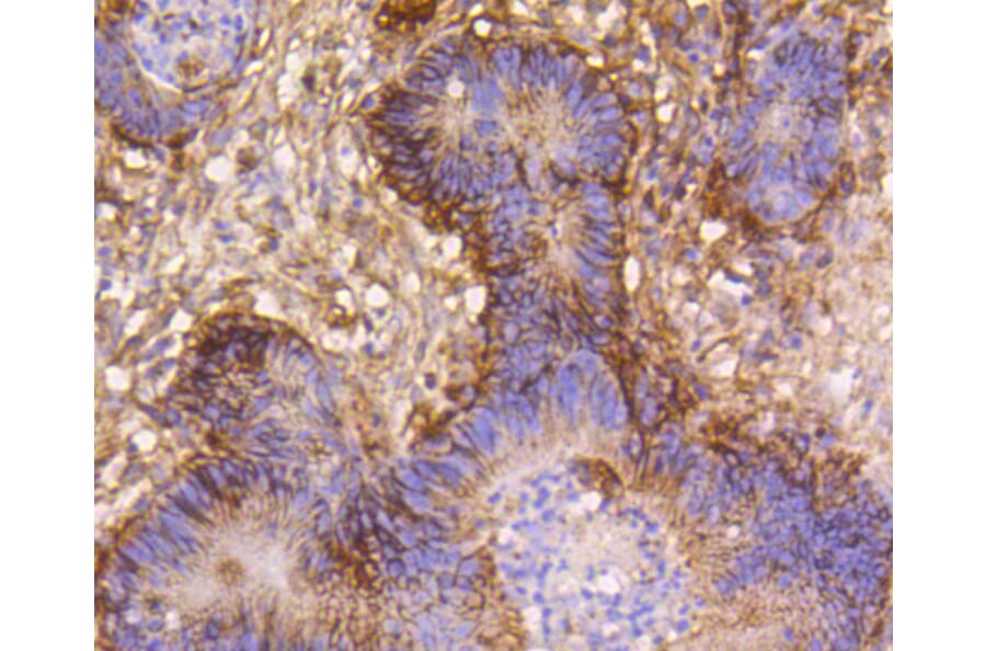 Immunohistochemistry - Anti-Integrin beta 1 Antibody (A11060) - Antibodies.com