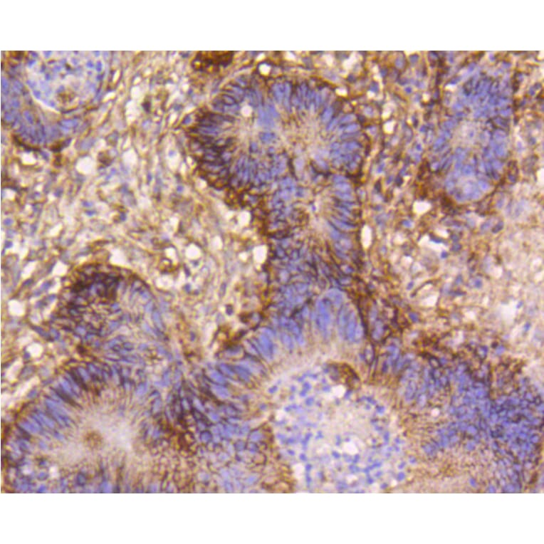 Immunohistochemistry - Anti-Integrin beta 1 Antibody (A11060) - Antibodies.com