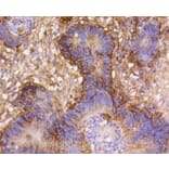 Immunohistochemistry - Anti-Integrin beta 1 Antibody (A11060) - Antibodies.com