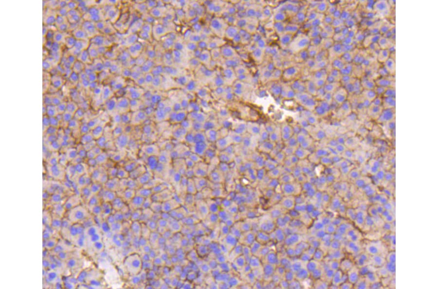 Immunohistochemistry - Anti-Integrin beta 1 Antibody (A11060) - Antibodies.com