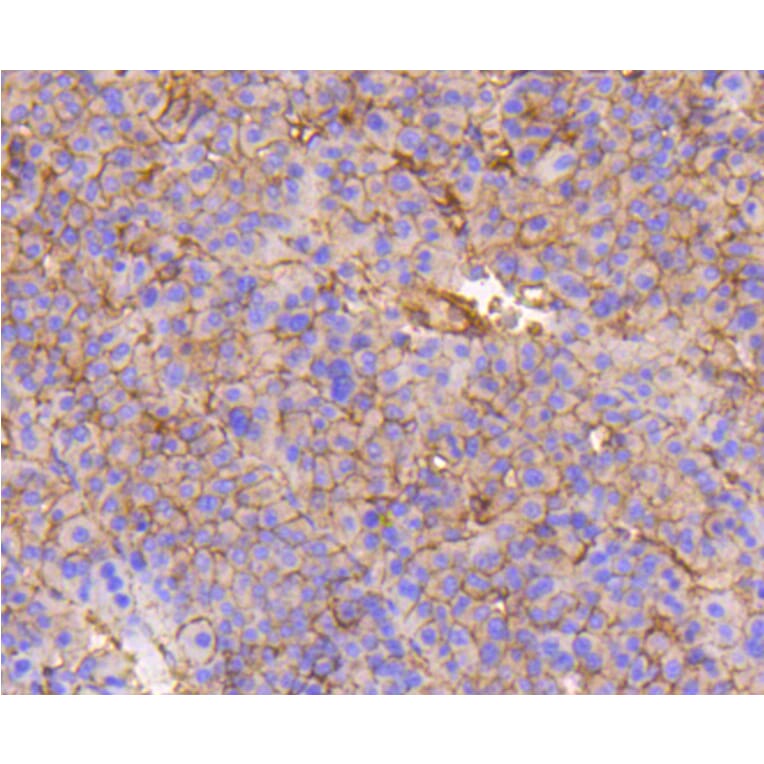 Immunohistochemistry - Anti-Integrin beta 1 Antibody (A11060) - Antibodies.com