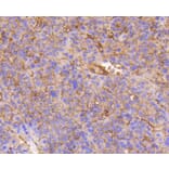 Immunohistochemistry - Anti-Integrin beta 1 Antibody (A11060) - Antibodies.com