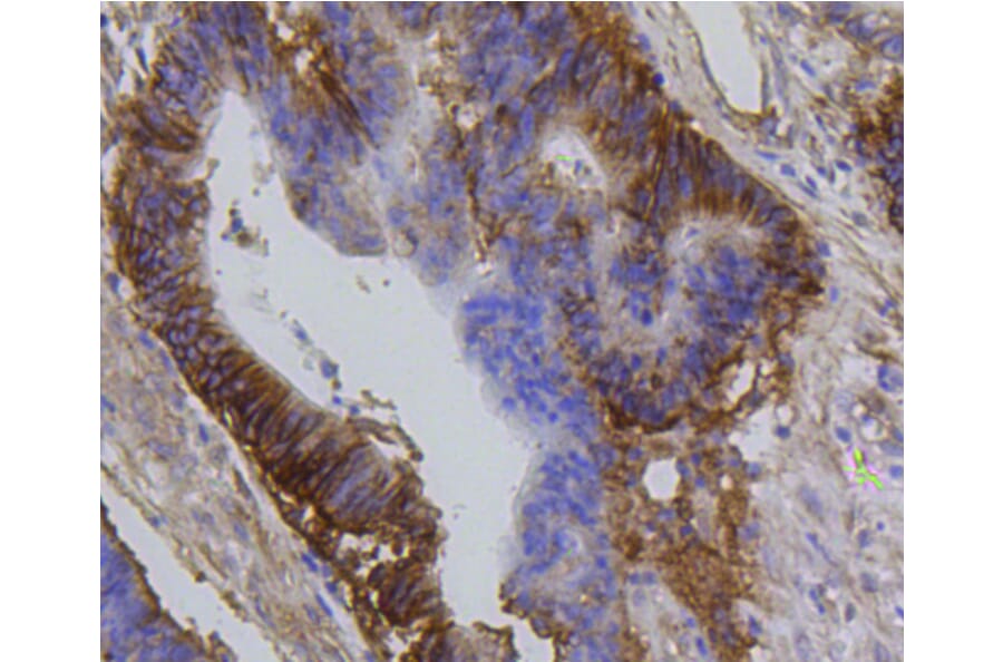 Immunohistochemistry - Anti-Integrin beta 1 Antibody (A11060) - Antibodies.com