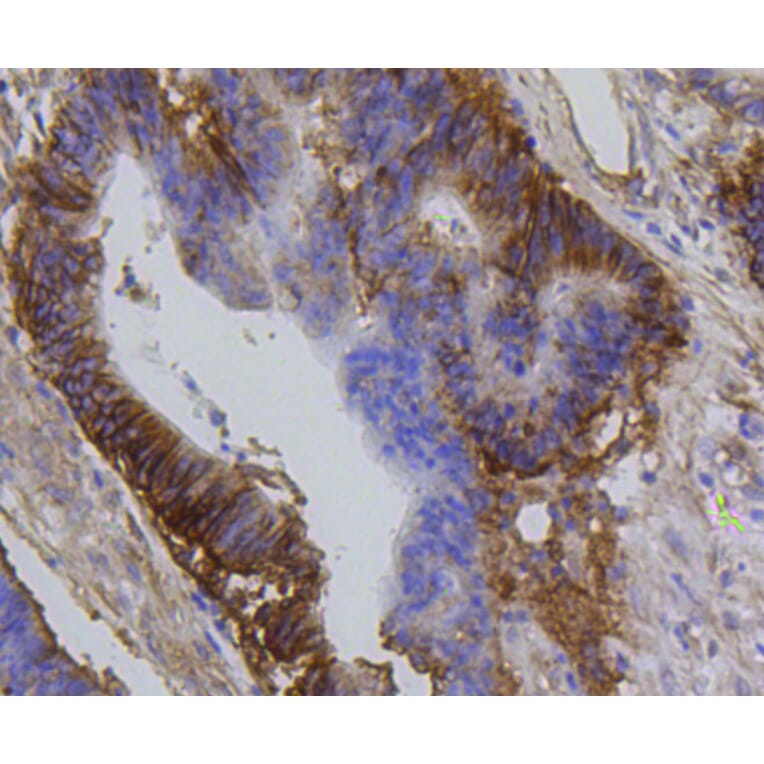 Immunohistochemistry - Anti-Integrin beta 1 Antibody (A11060) - Antibodies.com