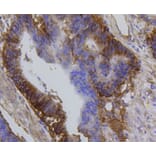 Immunohistochemistry - Anti-Integrin beta 1 Antibody (A11060) - Antibodies.com