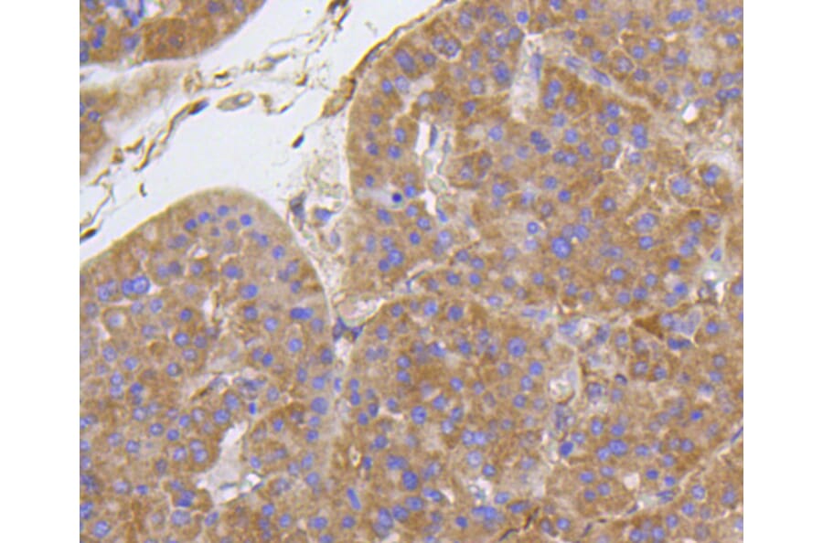 Immunohistochemistry - Anti-Integrin beta 1 Antibody (A11060) - Antibodies.com