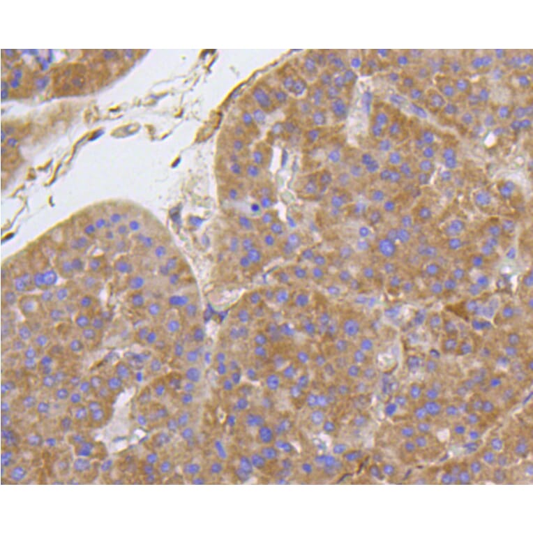 Immunohistochemistry - Anti-Integrin beta 1 Antibody (A11060) - Antibodies.com