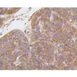 Immunohistochemistry - Anti-Integrin beta 1 Antibody (A11060) - Antibodies.com