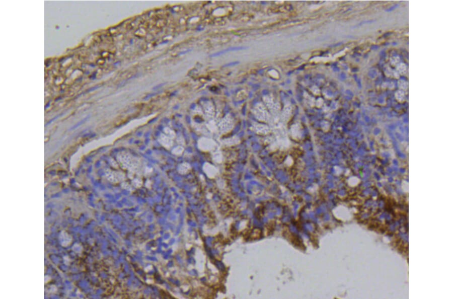 Immunohistochemistry - Anti-Integrin beta 1 Antibody (A11060) - Antibodies.com