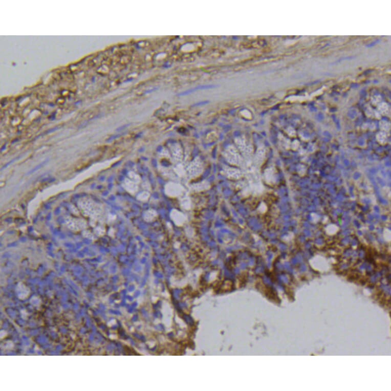 Immunohistochemistry - Anti-Integrin beta 1 Antibody (A11060) - Antibodies.com