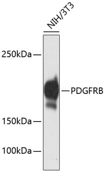 Western blot analysis of extracts of NIH/3T3 cells, using Anti-PDGFRB Antibody (A11071).
Secondary antibody: Goat Anti-Rabbit IgG (H+L) (HRP) (AS014) at 1:10,000 dilution.
Lysates / proteins: 25µg per lane.
Blocking buffer: 3% non-fat dry milk in TBST.