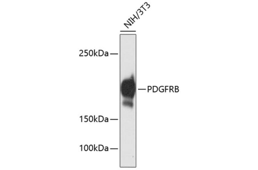 Western Blot - Anti-PDGFRB Antibody (A11071) - Antibodies.com