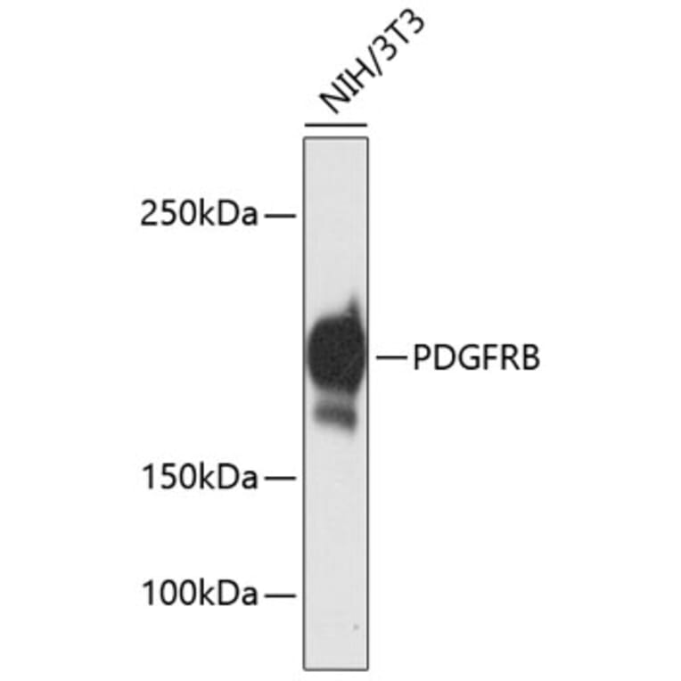 Western Blot - Anti-PDGFRB Antibody (A11071) - Antibodies.com