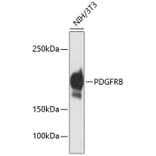 Western Blot - Anti-PDGFRB Antibody (A11071) - Antibodies.com