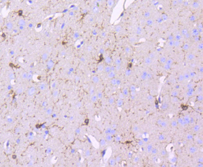 Immunohistochemistry of paraffin-embedded mouse brain using Anti-PDGFRB Antibody (A11071) at dilution of 1:100 (40x lens).