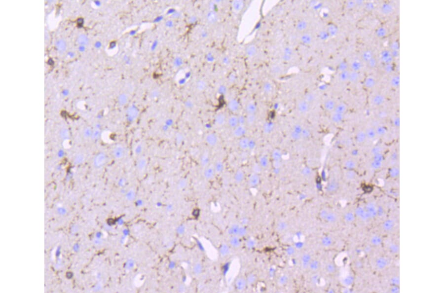 Immunohistochemistry - Anti-PDGFRB Antibody (A11071) - Antibodies.com