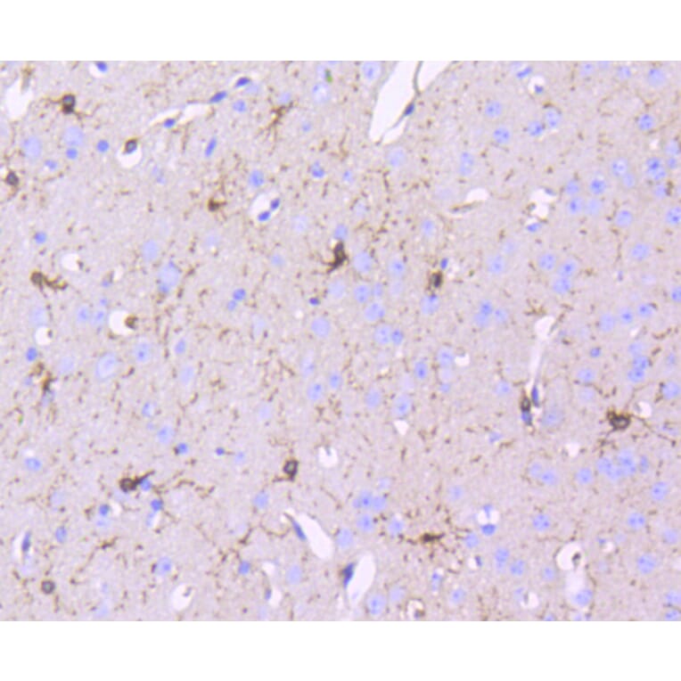 Immunohistochemistry - Anti-PDGFRB Antibody (A11071) - Antibodies.com