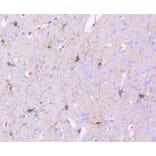 Immunohistochemistry - Anti-PDGFRB Antibody (A11071) - Antibodies.com