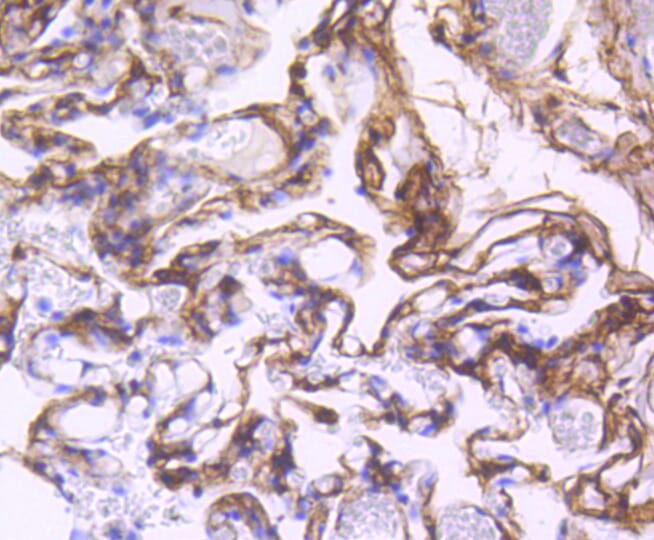 Immunohistochemistry of paraffin-embedded human lung using Anti-PDGFRB Antibody (A11071) at dilution of 1:100 (40x lens).