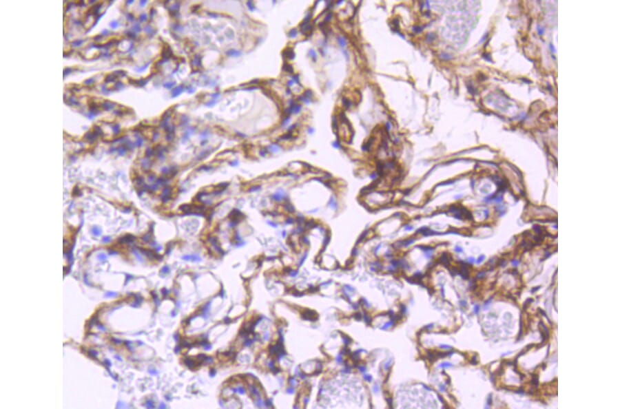 Immunohistochemistry - Anti-PDGFRB Antibody (A11071) - Antibodies.com