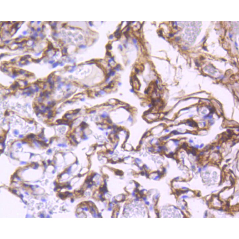 Immunohistochemistry - Anti-PDGFRB Antibody (A11071) - Antibodies.com