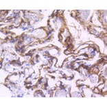 Immunohistochemistry - Anti-PDGFRB Antibody (A11071) - Antibodies.com