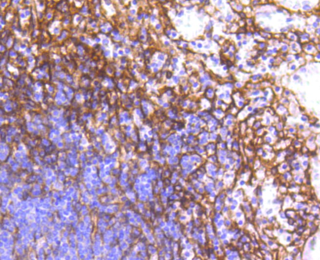 Immunohistochemistry of paraffin-embedded human spleen using Anti-PDGFRB Antibody (A11071) at dilution of 1:100 (40x lens).