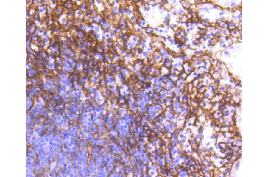Immunohistochemistry - Anti-PDGFRB Antibody (A11071) - Antibodies.com