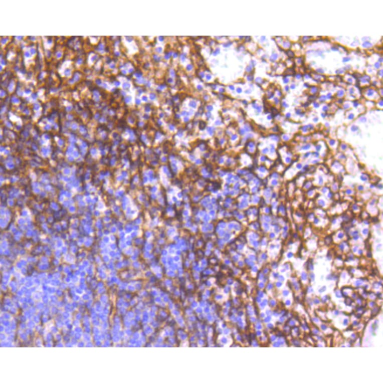 Immunohistochemistry - Anti-PDGFRB Antibody (A11071) - Antibodies.com