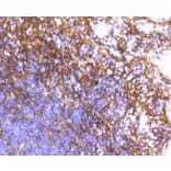 Immunohistochemistry - Anti-PDGFRB Antibody (A11071) - Antibodies.com