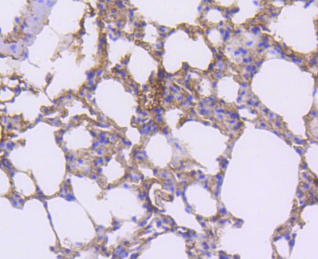 Immunohistochemistry of paraffin-embedded mouse lung using Anti-PDGFRB Antibody (A11071) at dilution of 1:100 (40x lens).