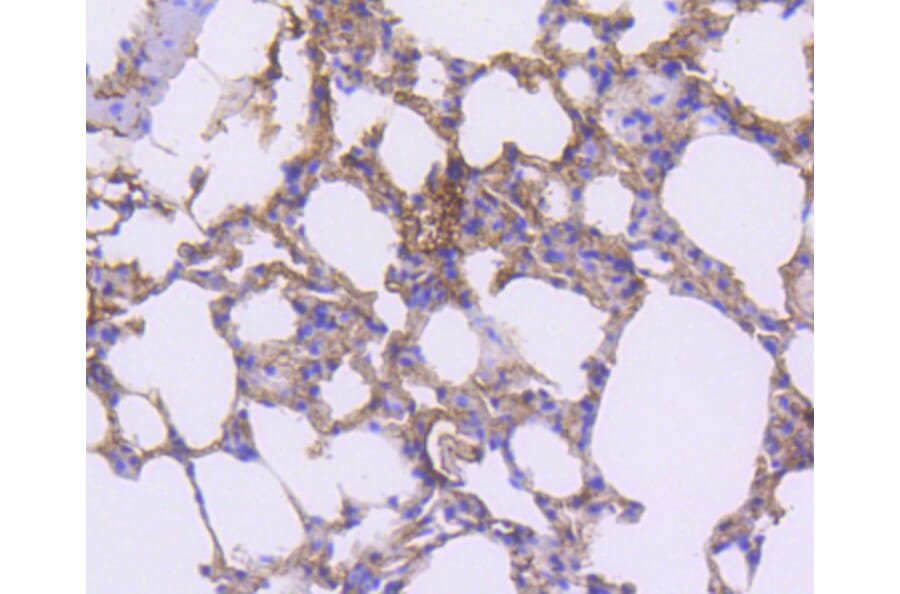 Immunohistochemistry - Anti-PDGFRB Antibody (A11071) - Antibodies.com